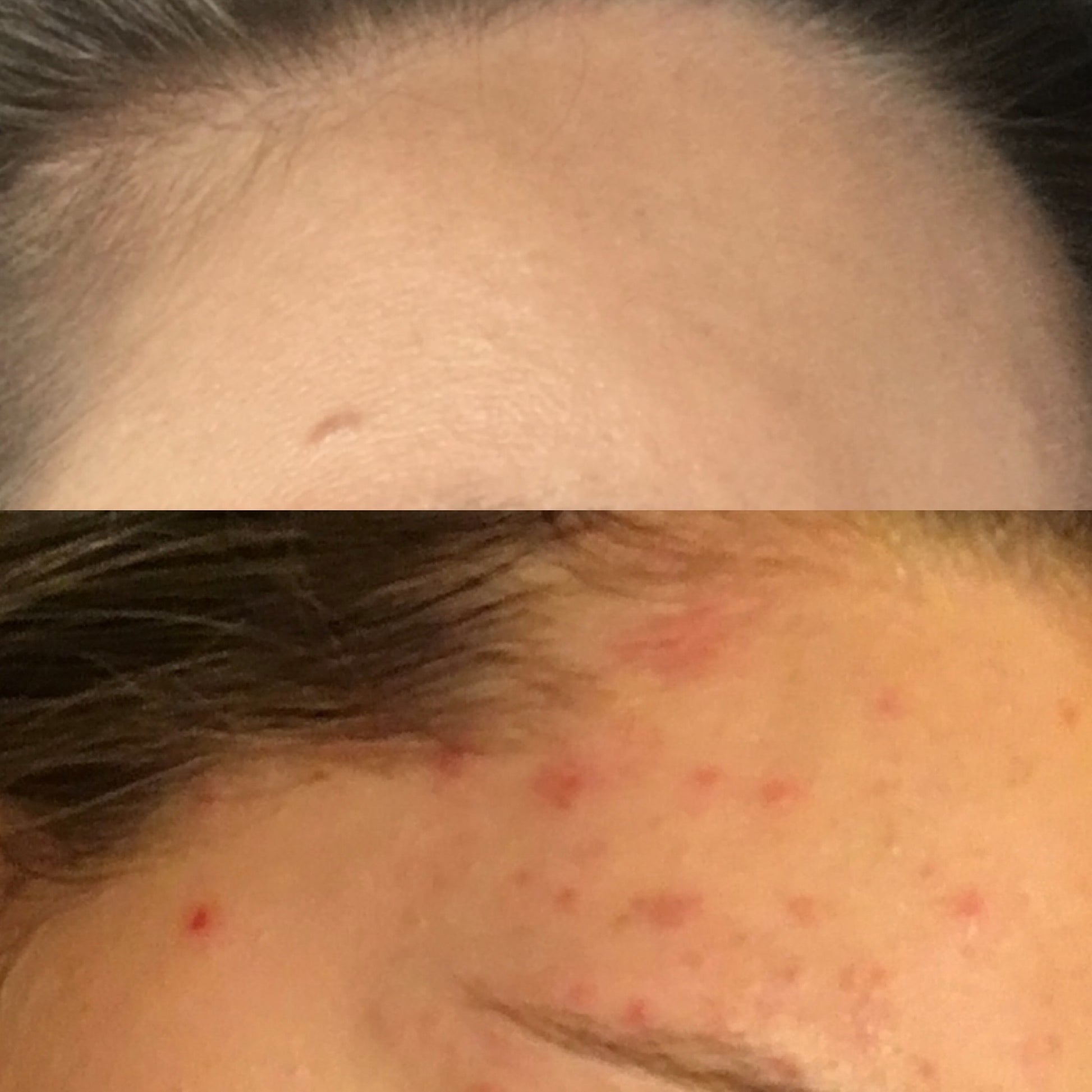 Australian Grown Skin + Lymphatic Support