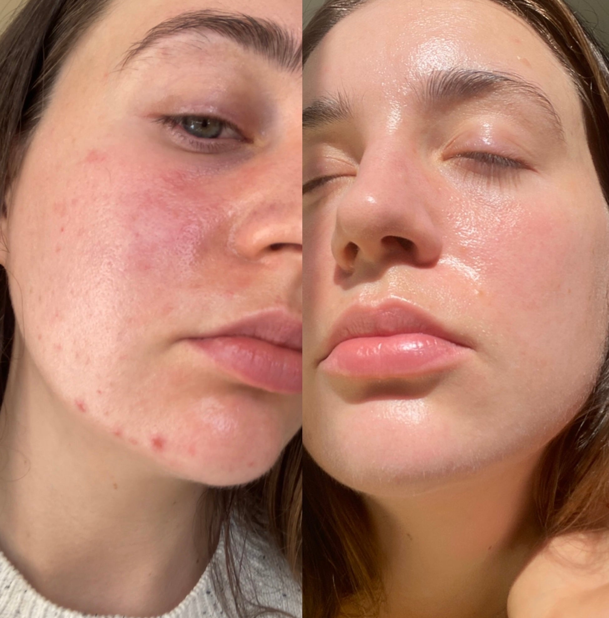 Australian Grown Skin + Lymphatic Support