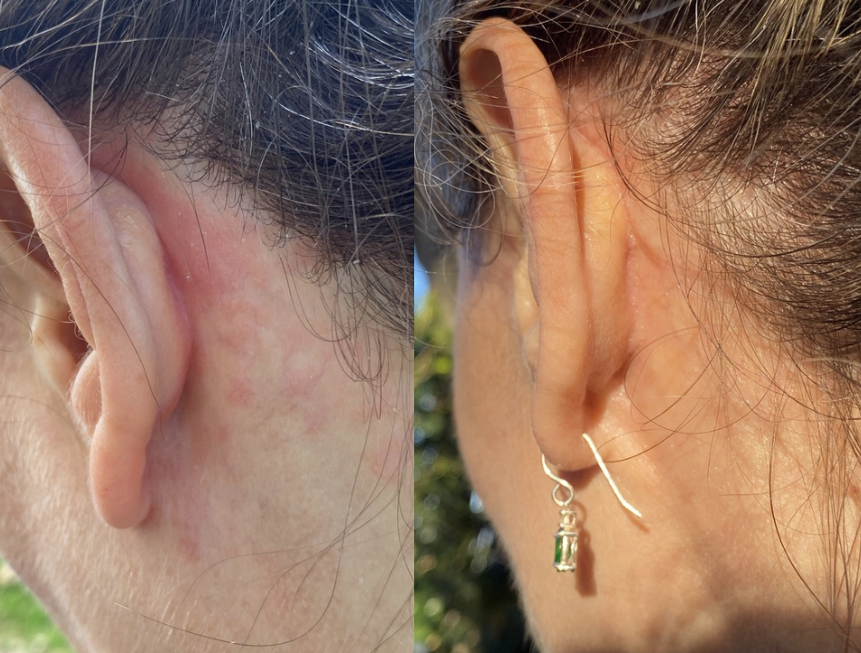 Australian Grown Skin + Lymphatic Support